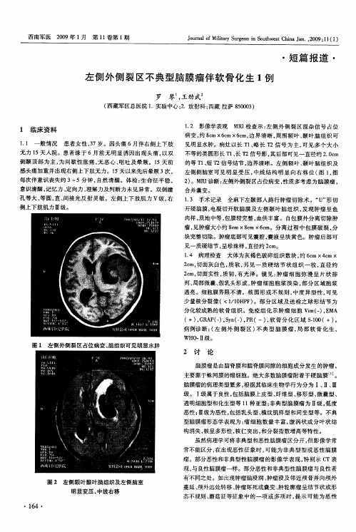 左侧外侧裂区不典型脑膜瘤伴软骨化生1例