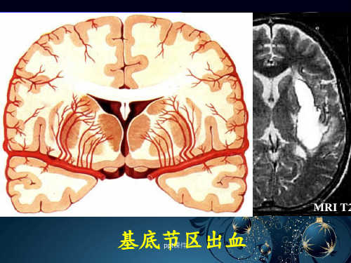 脑血管解剖(全套课件132P)  ppt课件