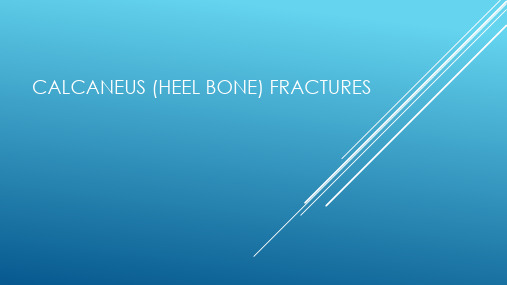 Calcaneus (Heel Bone) Fractures(跟骨骨折英文版)