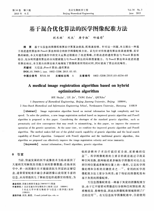 基于混合优化算法的医学图像配准方法