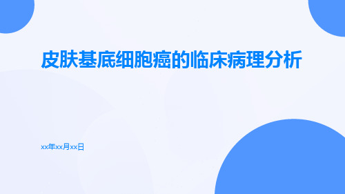 皮肤基底细胞癌的临床病理分析