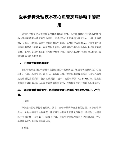 医学影像处理技术在心血管疾病诊断中的应用