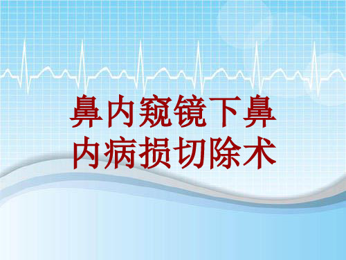 手术讲解模板：鼻内窥镜下鼻内病损切除术