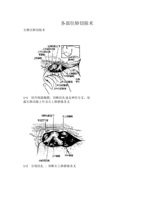 各位肺切除术 手术图谱