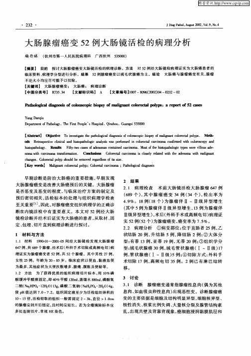 大肠腺瘤癌变52例大肠镜活检的病理分析