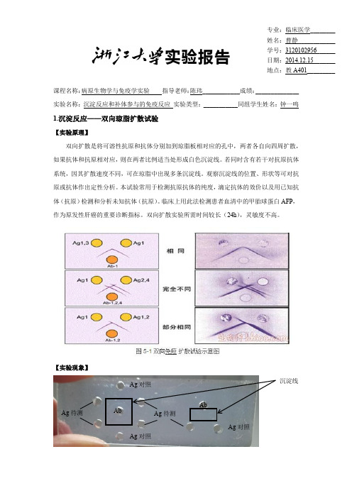 免疫学——沉淀反应