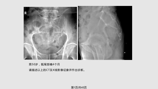 骨骼肌肉系统常见病多发病PPT课件