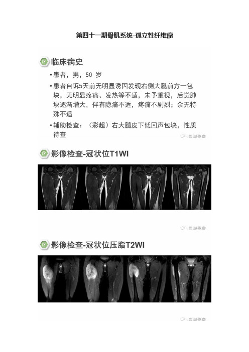 第四十一期骨肌系统-孤立性纤维瘤