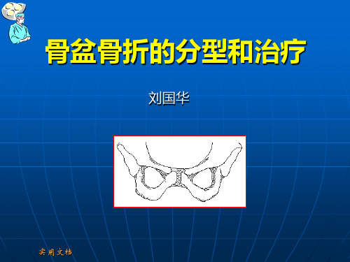 骨盆骨折的分型和治疗