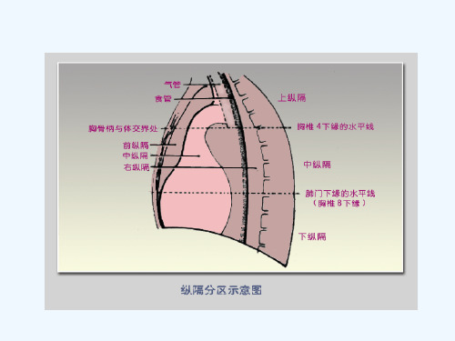 纵膈肿瘤影像诊断