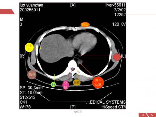 腹部CT  ppt课件