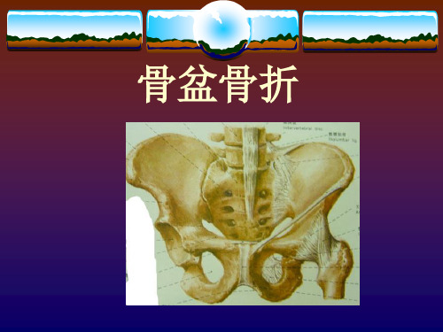 骨盆骨折课件PPT