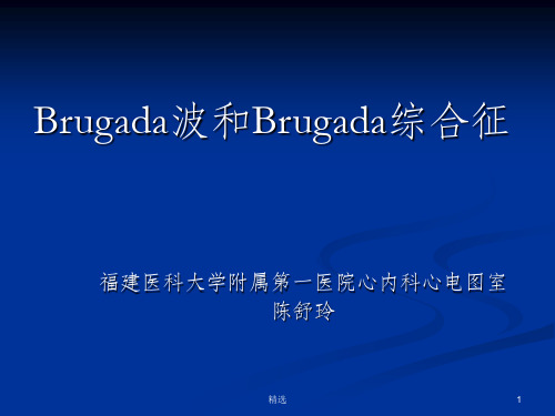 Brugada波和Brugada综合征PPT课件