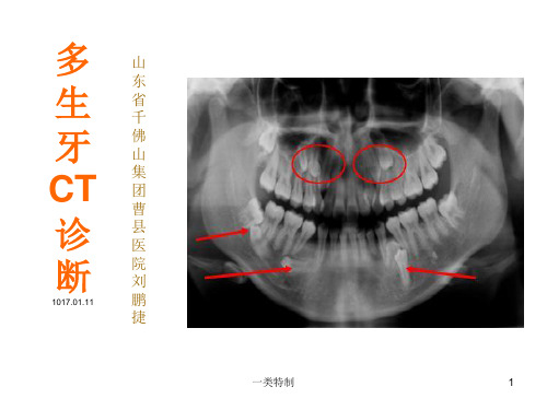 多生牙CT诊断[行业研究]