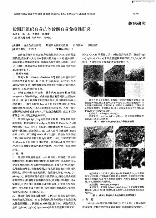 检测肝组织自身抗体诊断自身免疫性肝炎