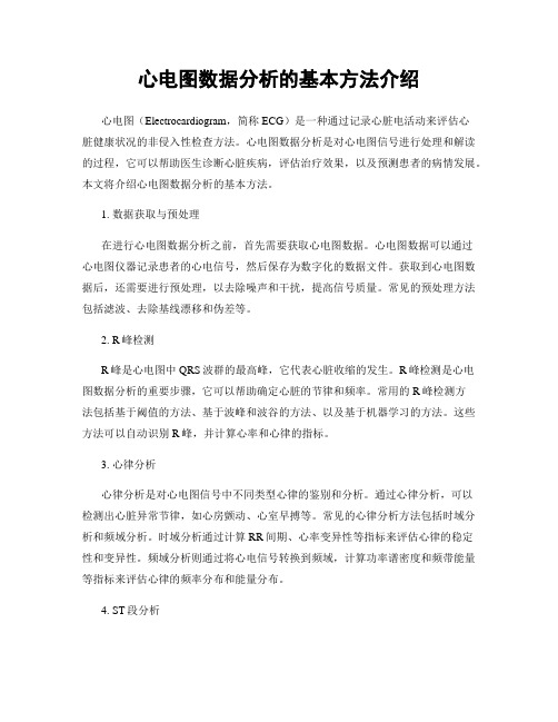 心电图数据分析的基本方法介绍