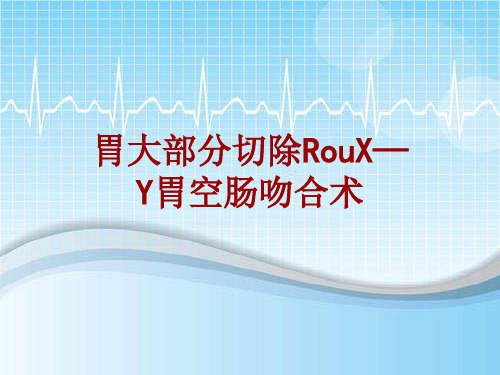 手术讲解模板：胃大部分切除RouX—Y胃空肠吻合术