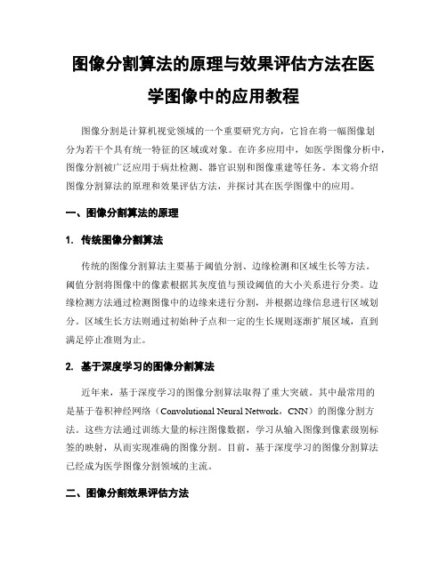 图像分割算法的原理与效果评估方法在医学图像中的应用教程