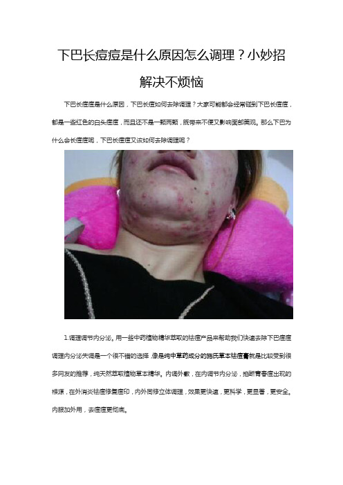 下巴长痘痘是什么原因怎么调理？小妙招解决不烦恼