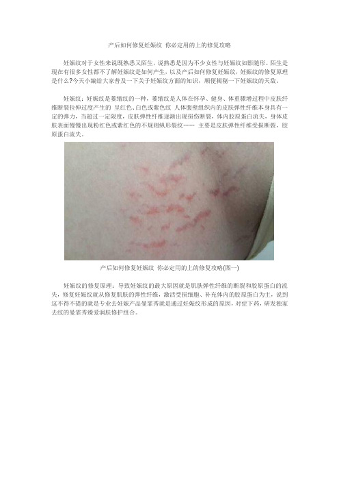 产后如何修复妊娠纹 你必定用的上的修复攻略