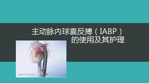 主动脉内球囊反搏(IABP)及其相关护理