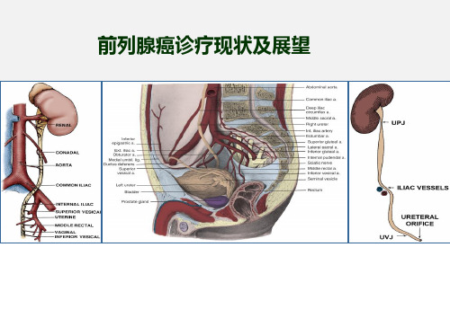 前列腺癌诊疗现状及展望