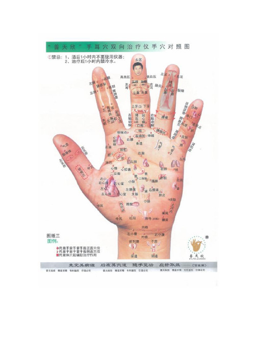 手诊图及治疗穴位