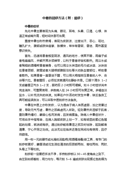 中暑的刮痧方法（附：撮痧）