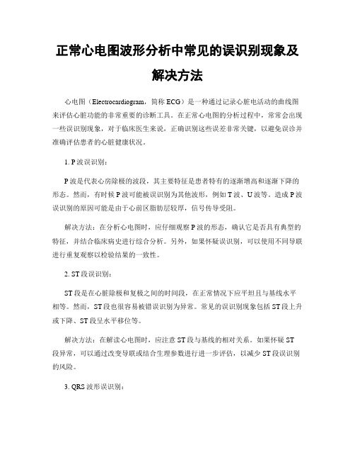 正常心电图波形分析中常见的误识别现象及解决方法