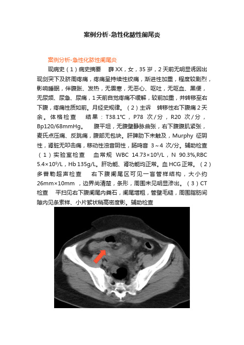 案例分析-急性化脓性阑尾炎