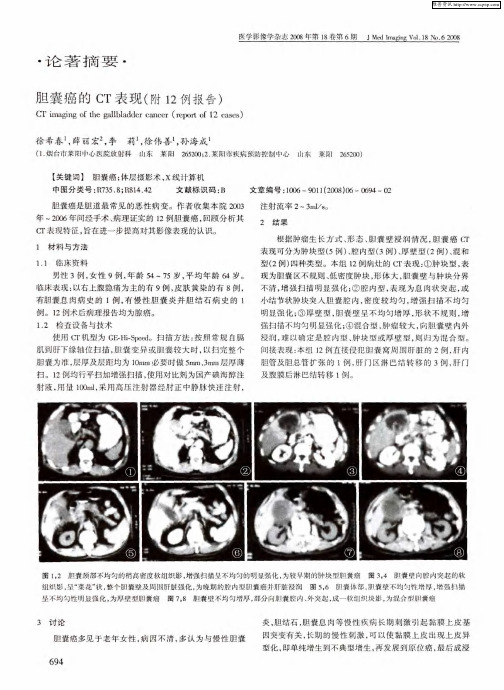 胆囊癌的CT表现(附12例报告)