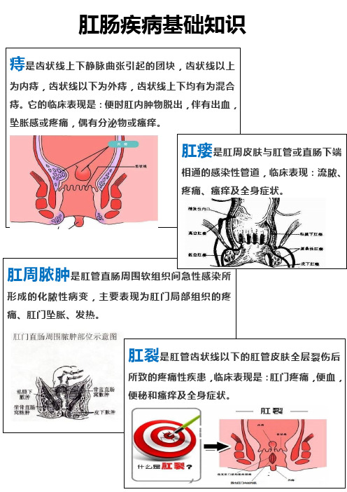 肛肠疾病护理宣教1