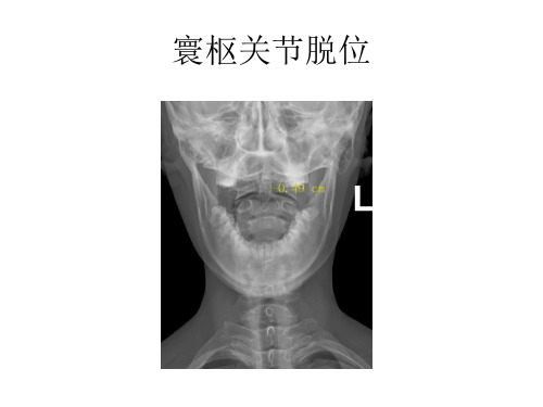 骨关节创伤图片精品PPT课件