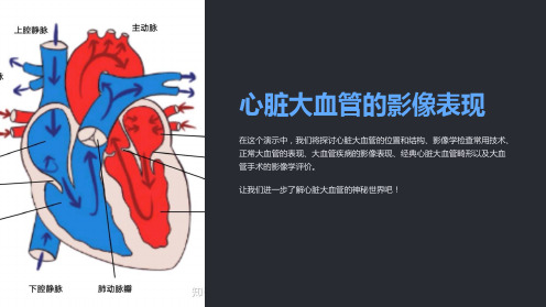 心脏大血管的影像表现