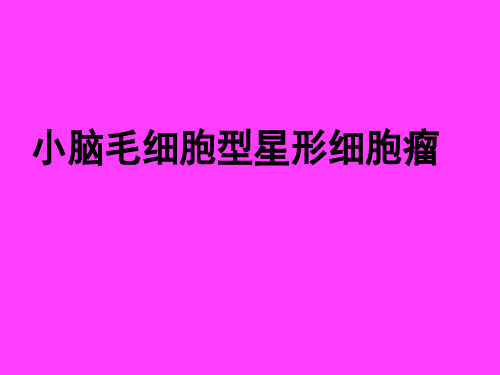 小脑毛细胞型星形细胞瘤影像诊断