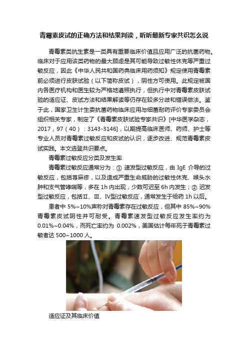 青霉素皮试的正确方法和结果判读，听听最新专家共识怎么说