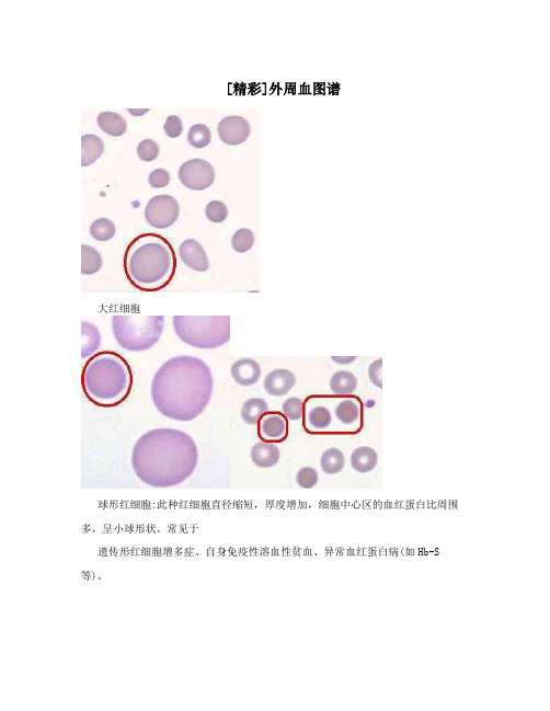 [精彩]外周血图谱