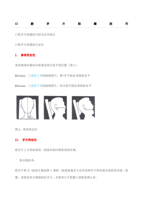 口腔牙片拍摄技巧