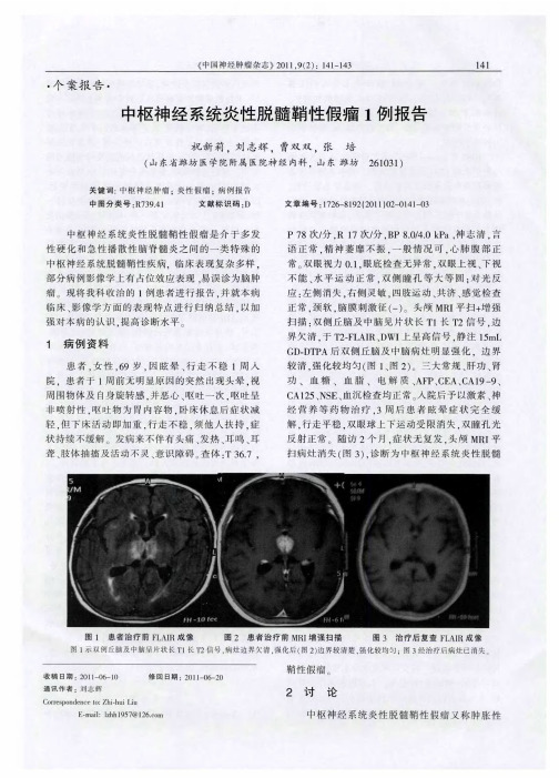 中枢神经系统炎性脱髓鞘性假瘤1例报告