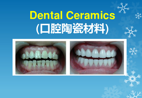 口腔学英文课件：Dental Ceramics