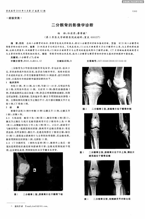 二分髌骨的影像学诊断