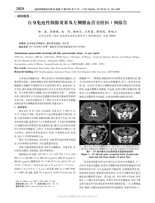 自身免疫性胰腺炎累及左侧髂血管旁