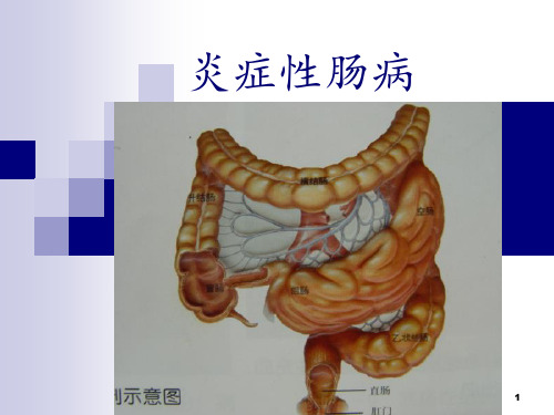 炎症性肠病(本科内科护理临床部分)PPT课件