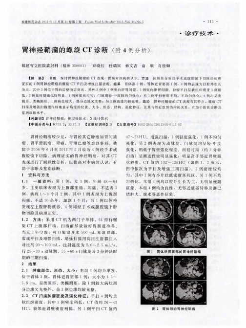 胃神经鞘瘤的螺旋CT诊断(附4例分析)