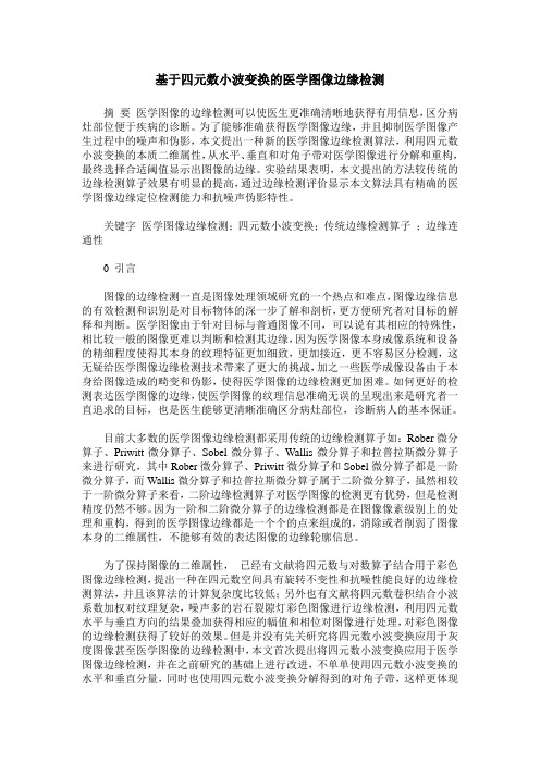 基于四元数小波变换的医学图像边缘检测