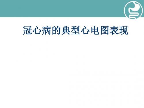 冠心病的典型心电图表现PPT演示课件