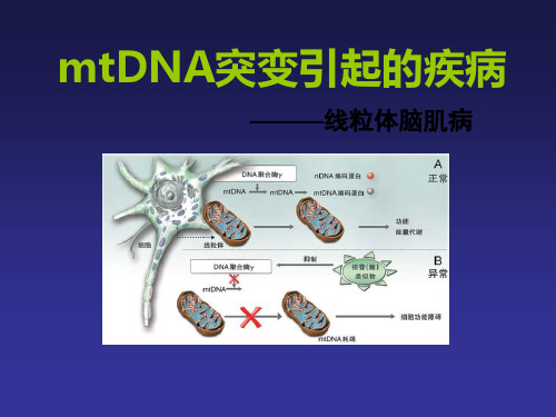 mtDNA引起的脑肌病