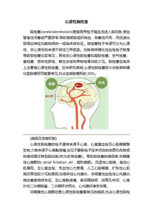 心源性脑栓塞