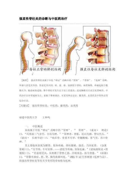 强直性脊柱炎的诊断与中医药治疗方法