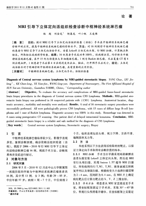 MRI引导下立体定向活组织检查诊断中枢神经系统淋巴瘤